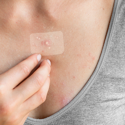 Truly Clear Hydrocolloid Target Patches