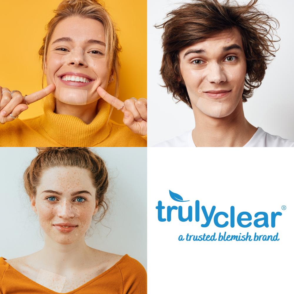 Comprehensive Care: From prevention to spot treatment, Truly Clear has a solution for every summer skin woe.